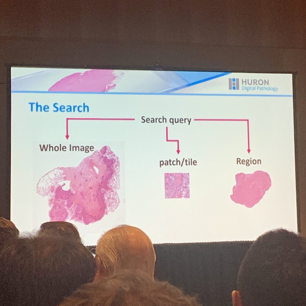 gtevaristomd's tweet photo. So what if you could input your digital slide to search for matching histopath features &amp; associated pathology report findings? 🤔  
@hurondp @HamidRTizhoosh  @KIMIA_Lab Getting us all excited about WSI Image Search here at #PathVisions19 👏🏾 #AI #digitalpathology https://t.co/0ONzQENZhN