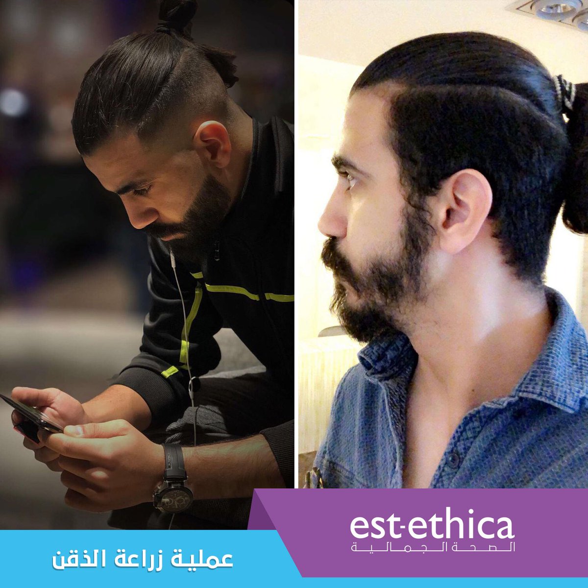 mediogluar's tweet photo. نتاءج عملية زراعة لحية في مجموعة شمافي ايست ايثيكا
#زراعة_شعر_اللحية #زراعة_شعر #بيركوتان #اقتطاف #عملية_زراعة_شعر #اف_يو_اي #تقنية_البيركوتان #لحية #ذقن #estethica #hairtransplant #beardtransplant https://t.co/ToUcSKxeJJ