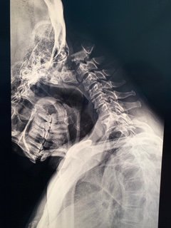 CMI_missions's tweet photo. Follow our new Facebook page, Instagram and Twitter to hear about this unprecedented case that blessed a disabled Mozambican man with a second chance at life following a near decapitation. 
Facebook - CMI
Instagram@cmitx
Twitter @CMI_missions https://t.co/cxD02ZgofP