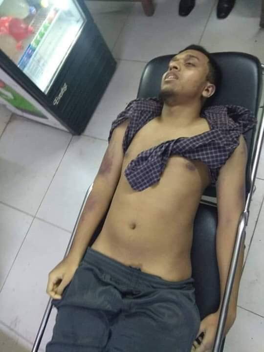 RaheemOxford's tweet photo. #Bangladesh🇧🇩Engineering Technology #UniversityStudent Has been #killed by @Illegal ruling party students wing in the Campus,after he criticised on Facebook Post @Hasina @sajeebwazed pro Indian relations as #Indianpuppet.who serving India Interest first.Peoples Hate Ugly @Face https://t.co/IyjlYaOol5