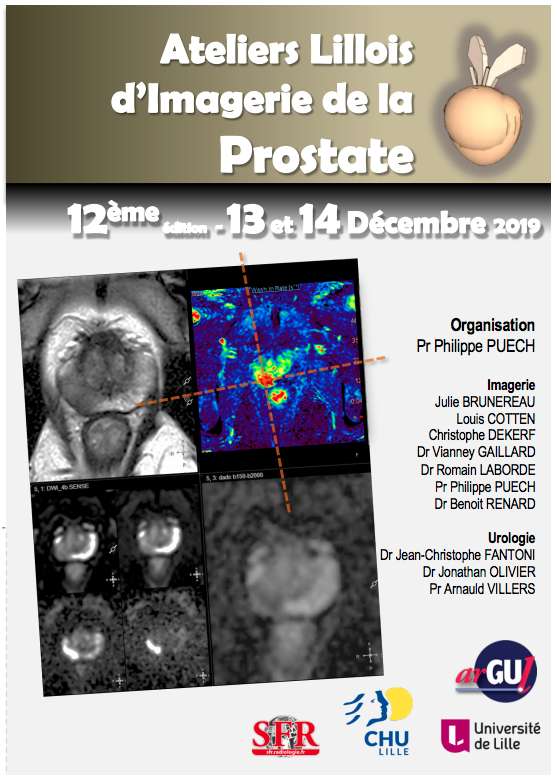 Le service d'imagerie génito-urinaire du CHU de Lille organise les 13 et 14 décembre une formation à l'interprétation de l'imagerie de la prostate. 
6h de cas cliniques sur tablettes iPad Pro (A4)
Ouvert aux radiologues, mais aussi aux urologues.
argul.fr