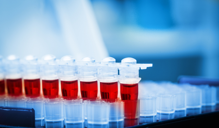 aus_stockreport's tweet photo. @OrthocellLtd has garnered significant attention as a #company positioned for future #growth in the lucrative health-based #BiotechMarket, following a series of positive announcements made about successful #ClinicalTrials (...) Click here to read more : https://t.co/0c9bygZqJP https://t.co/Gv07hrXSHa