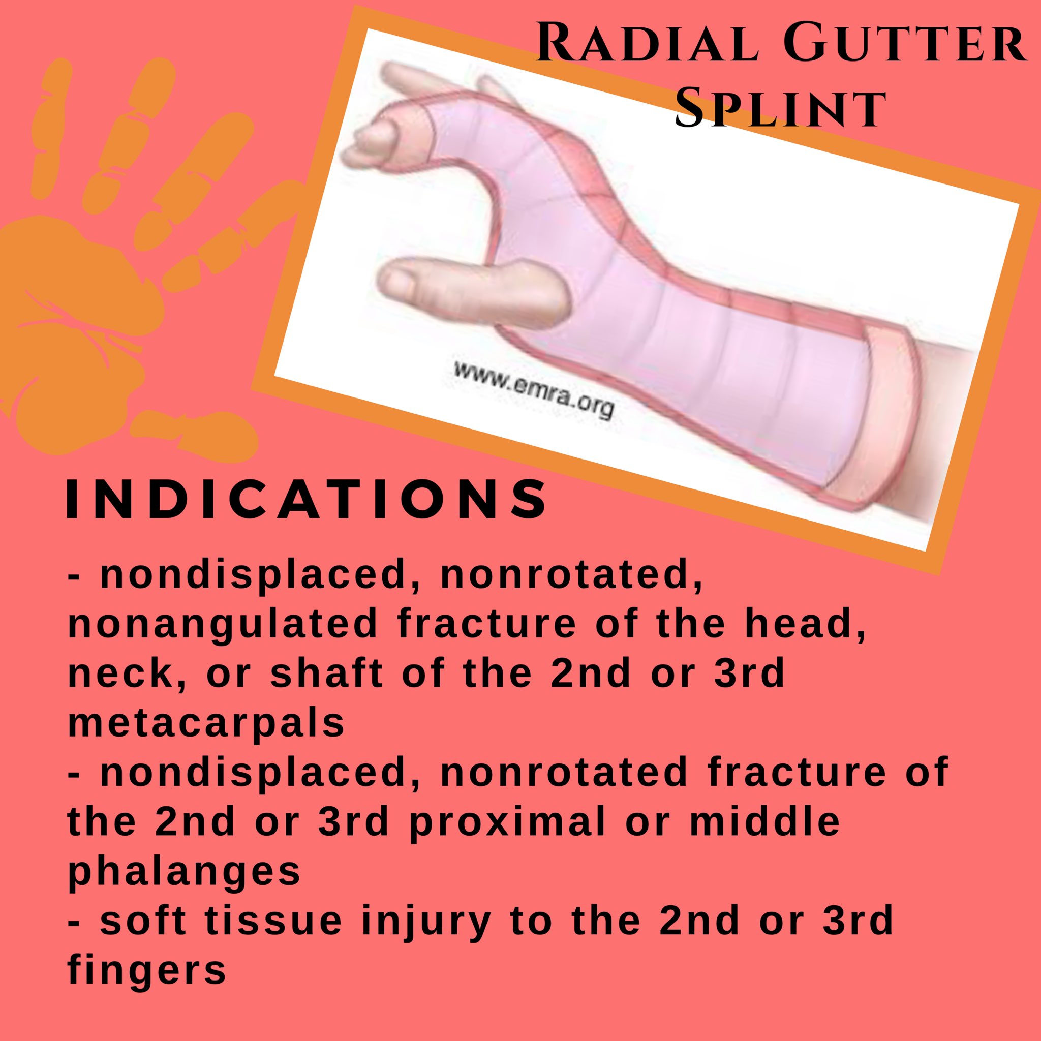 Metacarpal fractures sciencedirect 48 off