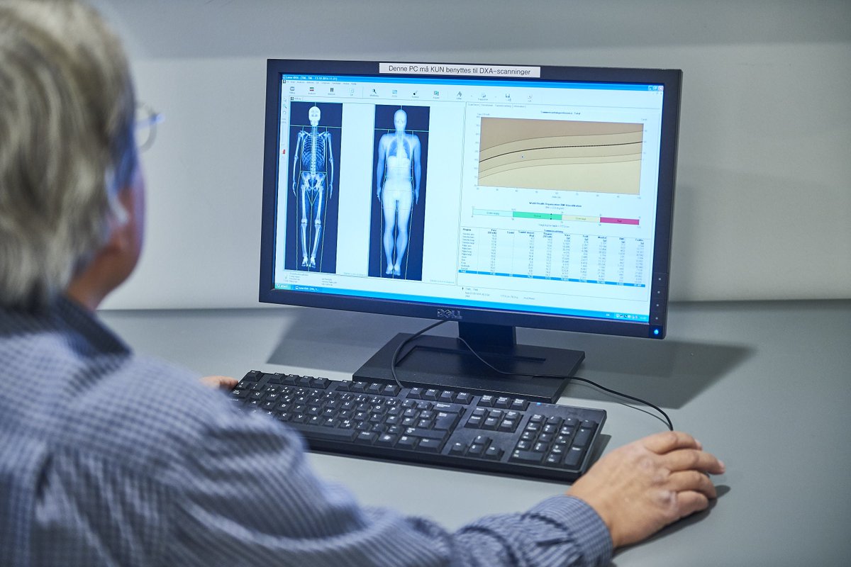 Mænd og kvinder søges til studie der undersøger effekt af fiberrigt kosttilskud på blodsukkerregulering og tarmens bakteriesammensætn. For at deltage skal du bla være 30 - 65 år og have BMI på mindst 31 nexs.ku.dk/om_nexs/forsog… #ErnæringKU #Forsøgsperson #Kosttilskud <a href="/science_ku/">SCIENCE - KU</a>