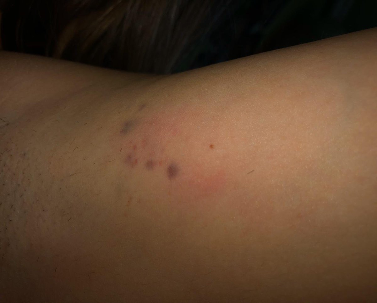 ClubNanclares's tweet photo. Desde el club  queremos denunciar la agresion sufrida tras el partido que enfrentó al club @CDAlegria  y @ClubNanclares en Alegria Un aficionado salto al campo al finalizar el partido agarro y tiro agrediendo a la jugadora del club deportivo Nanclares menor de edad https://t.co/ZBTIufckQQ