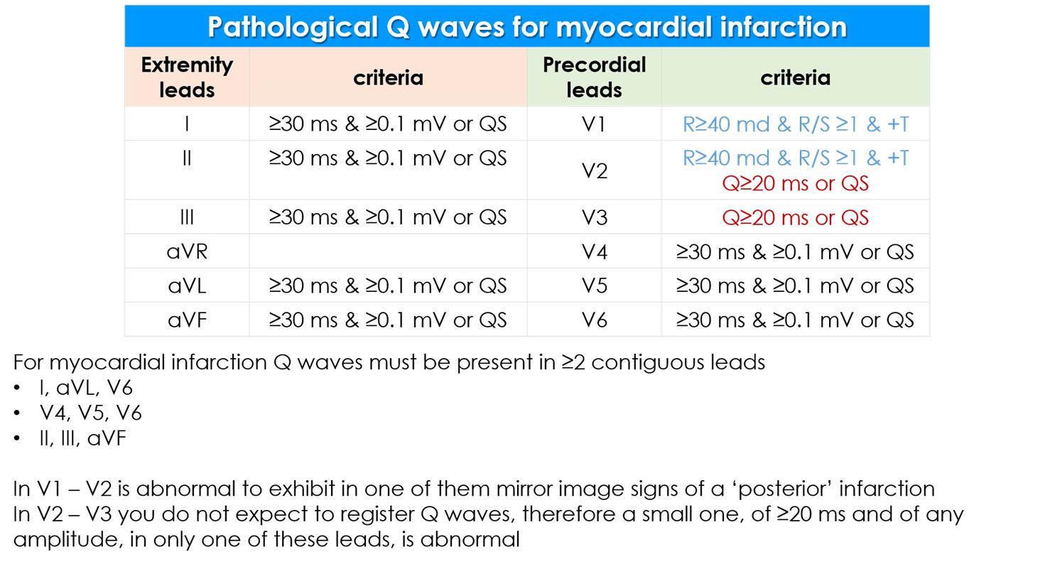 Abnormal Q Wave