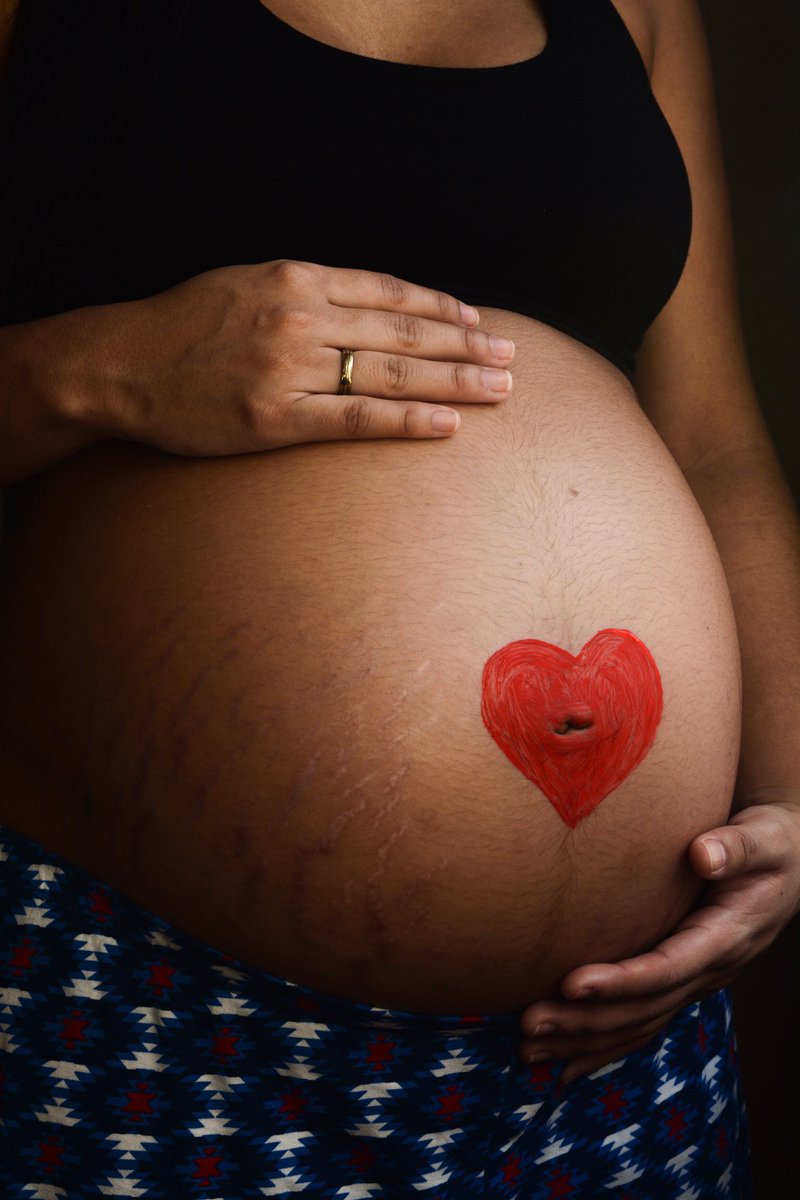 On vous dit tout sur les vergetures dans notre article du jour. Quoi, quand, où, comment et pourquoi ? Avec des solutions naturelles bien sûr ! Bonne lecture... ow.ly/JgXg50wFIQi
#secretsdejoelle #ptitesmaniesdejoelle #maman #grossesse #vergetures #mumtobe #madeinfrance