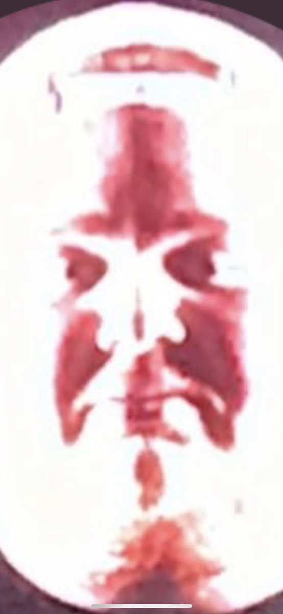 Carter Lee tweet media