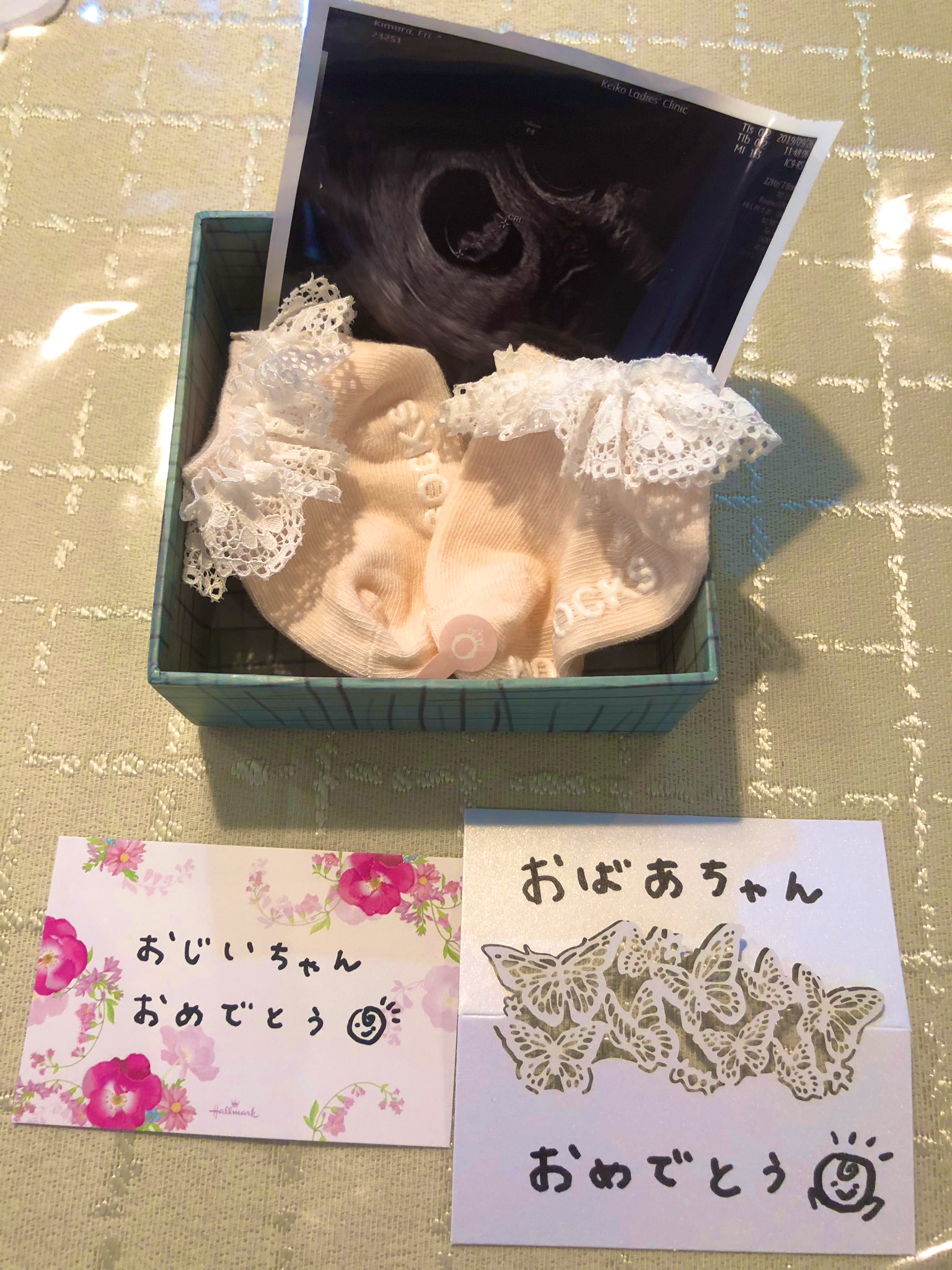O Xrhsths えりらざぴ She Ceo Cco Sto Twitter お母さんとおばあちゃんにサプライズ妊娠報告したよ ギフトボックスに赤ちゃん用のソックス とメッセージカード入れて渡したら 最初全く気付いてなくて お母さん気付いた後おばあちゃん絶叫 笑 T Co