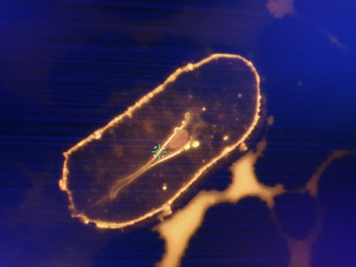 SSaeifar's tweet photo. Picking shiny #Single_Cells
#MMITeam
#Single_Cell_Isalation
#goetheuniversity https://t.co/V2aRh6QTzs