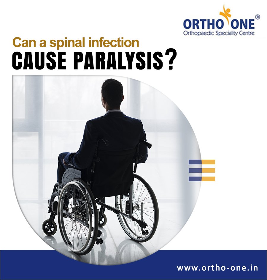 orthooneindia's tweet image. Spinal cord infections are rare. When it occurs an infection may spread.
So when left untreated, a spinal cord infection can result in spinal cord compression.
Visit :ortho-one.in
Book : ortho-one.in/book-appointme…
#Health #orthoone #Spinal_Tumor #Coimbatore