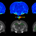 Photo by Neuroplasticity and Multimodal Imaging (@ImagingAnd)