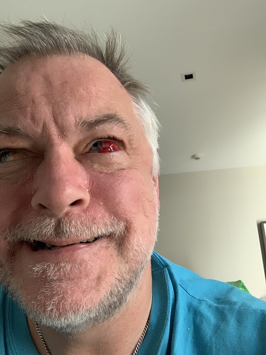 Papanomalyxd's tweet photo. It is a dangerous job, being a Youtuber. 😎 https://t.co/nQSTYudBel