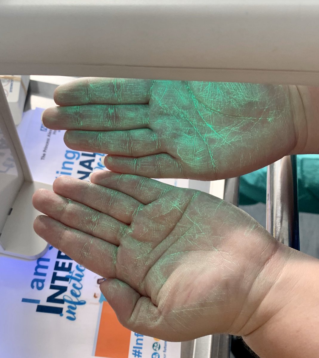 kimcabiles's tweet photo. Before and after photos showing the common areas we tend to miss when we’re washing our hands

Don’t give germs a helping hand, wash your hands and break the chain of infection! 

#IPCWeek2019 @NHSHarlow 
#InfectionPreventionIsEverybodysBusiness 
#handhygiene 

@IPCT_PAH https://t.co/zwymYY1gps
