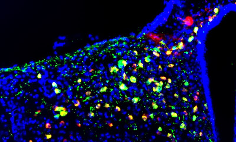 claytonsbingham's tweet photo. Sleep to forget: A population of hypothalamic neurons that are active during REM sleep are involved in forgetting https://t.co/xEZMqHEs72 https://t.co/m123OYAur1