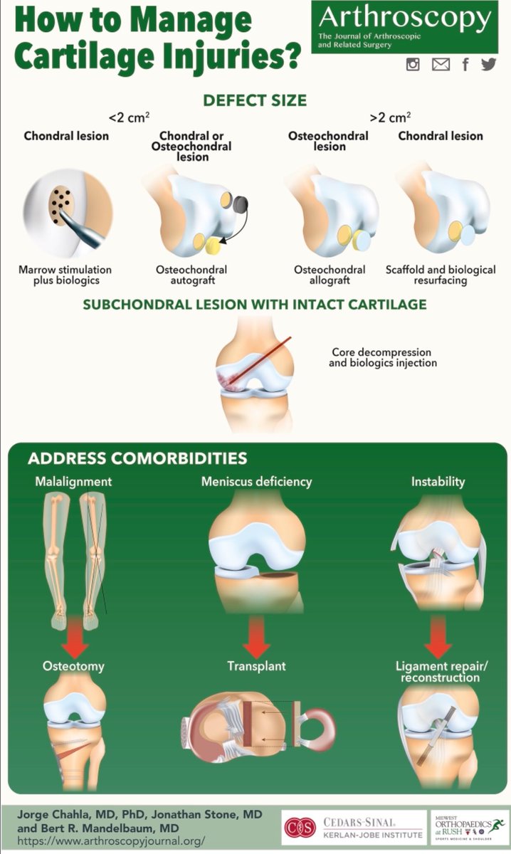 James Lubowitz, MD (@jameslubowitzmd) on Twitter photo How to manage cartilage injuries
October infographic in Full Color
<a href="/ArthroscopyJ/">Arthroscopy Journal</a> <a href="/MandelbaumMD/">Bert Mandelbaum, MD</a> <a href="/jachahla/">Jorge Chahla, MD, PhD</a> and Dr Stone How to manage cartilage injuries
October infographic in Full Color
<a href="/ArthroscopyJ/">Arthroscopy Journal</a> <a href="/MandelbaumMD/">Bert Mandelbaum, MD</a> <a href="/jachahla/">Jorge Chahla, MD, PhD</a> and Dr Stone