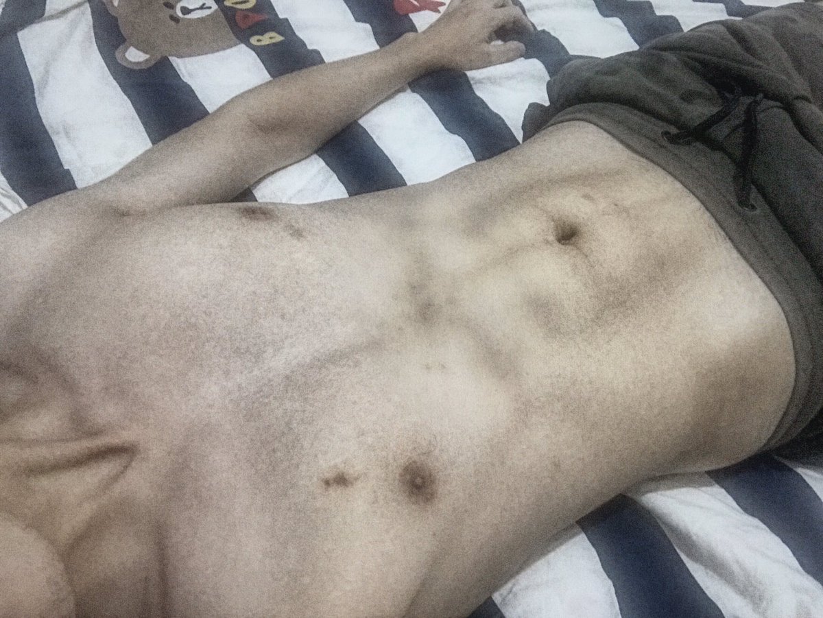 <a href="/cumcontrol10/">cumcontrol</a> 取精就好好取精嘛，一言不合就种草莓，三天了都还没消😒
（有在用力地挤腹肌，原谅我最近的身材不加滤镜不能看😂