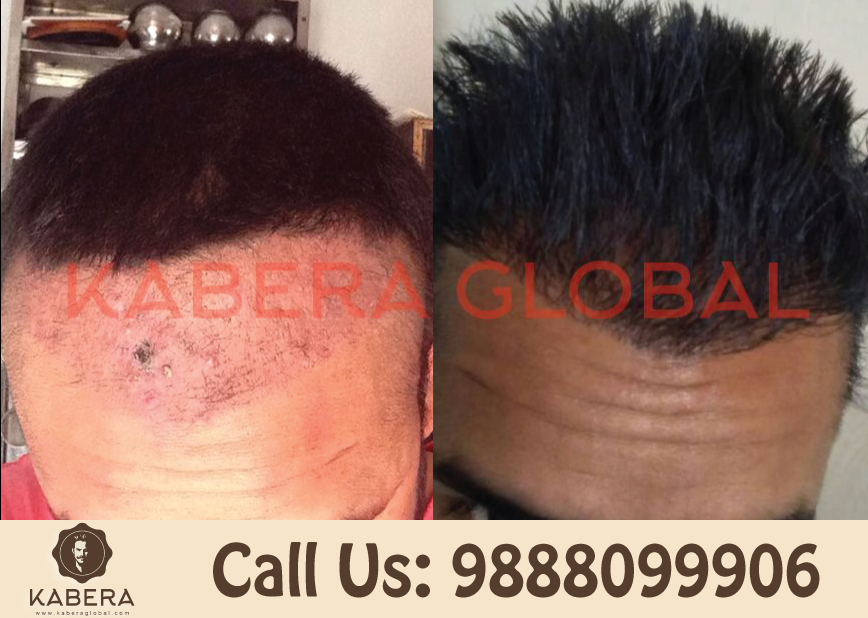Kabera Global (@kaberaglobal) / Twitter Kabera Global (@kaberaglobal) / Twitter