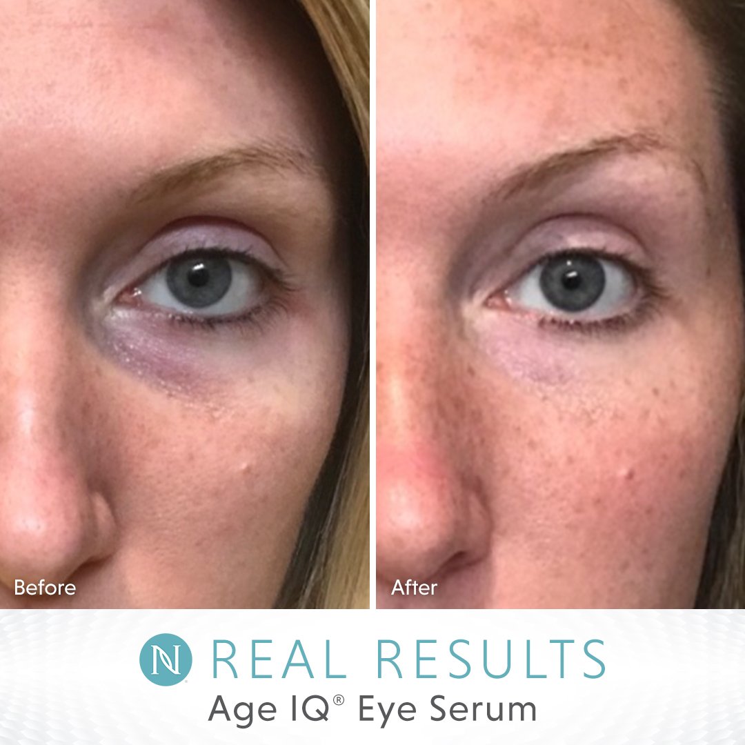 neora eye serum