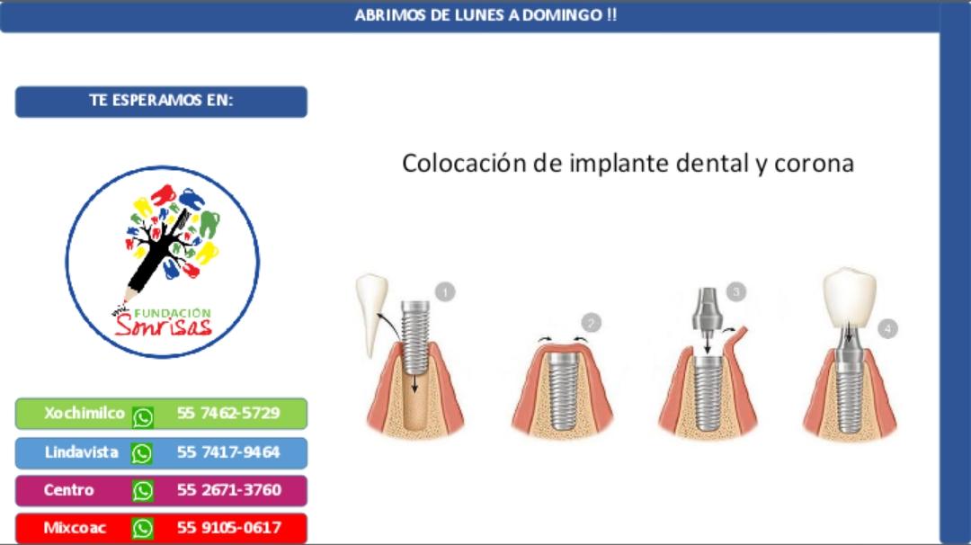 cdmilsonrisas's tweet photo. ¿Te hacen falta piezas dentales? ¡Acude a una cita de valoración gratuita con nosotros, tenemos el mejor plan de tratamiento para ti! Te esperamos de lunes a domingo. #sonreirnocuestanada #dentista #clínicadental https://t.co/JMLfo8XDTQ
