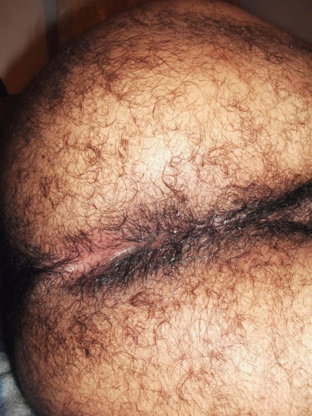 VermasACT's tweet photo. AsΓ me dejaron el culto. #hairyAss #culopeluo #arabman #gayarabman. Disponible en ccs https://t.co/VFTPIBaB2v