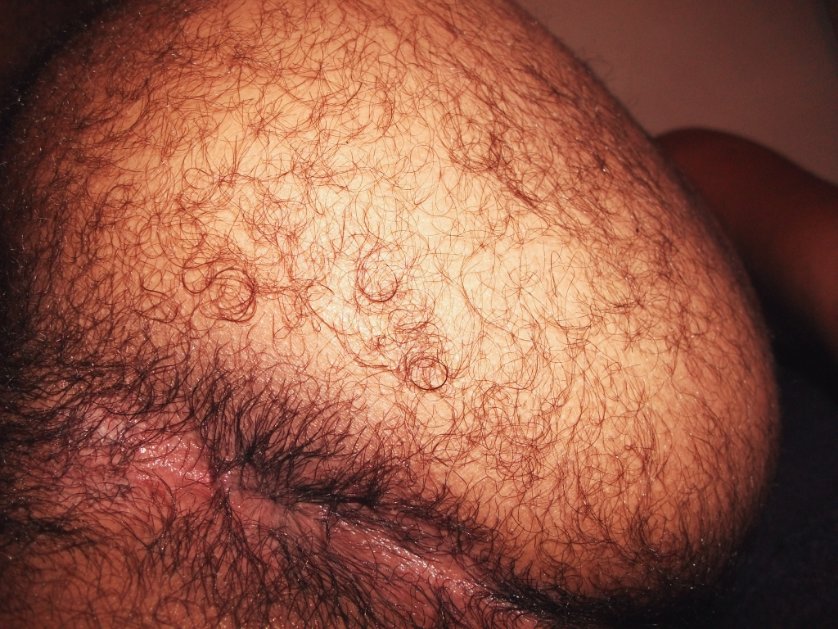 VermasACT's tweet photo. AsΓ me dejaron el culto. #hairyAss #culopeluo #arabman #gayarabman. Disponible en ccs https://t.co/VFTPIBaB2v