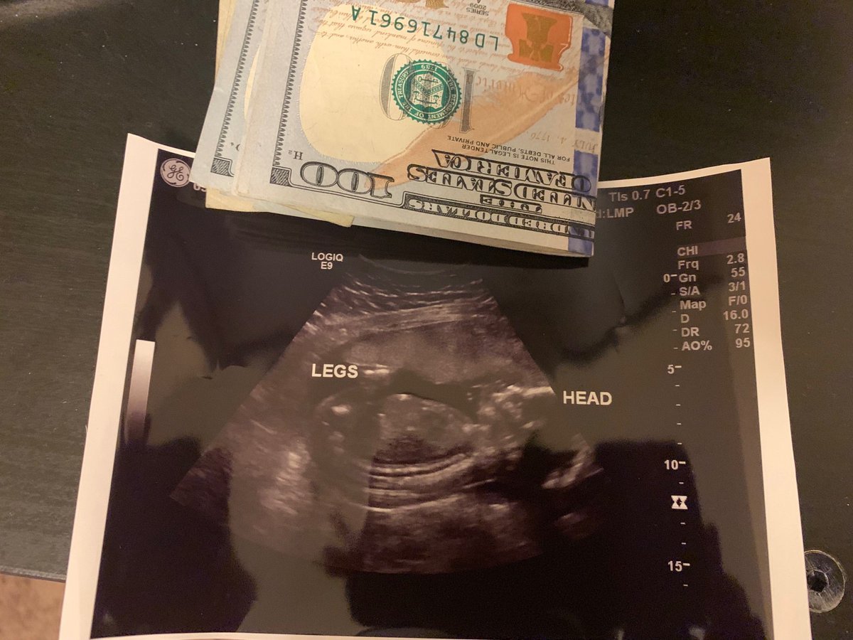 Jay_papiiii's tweet photo. I was about to go pay my rent and my unborn son handed me this cash and said, “Dad, It’s time for me to start carrying my own weight around here, I got this.” I love my son 😭❤️ https://t.co/YEggRSJ0Xo