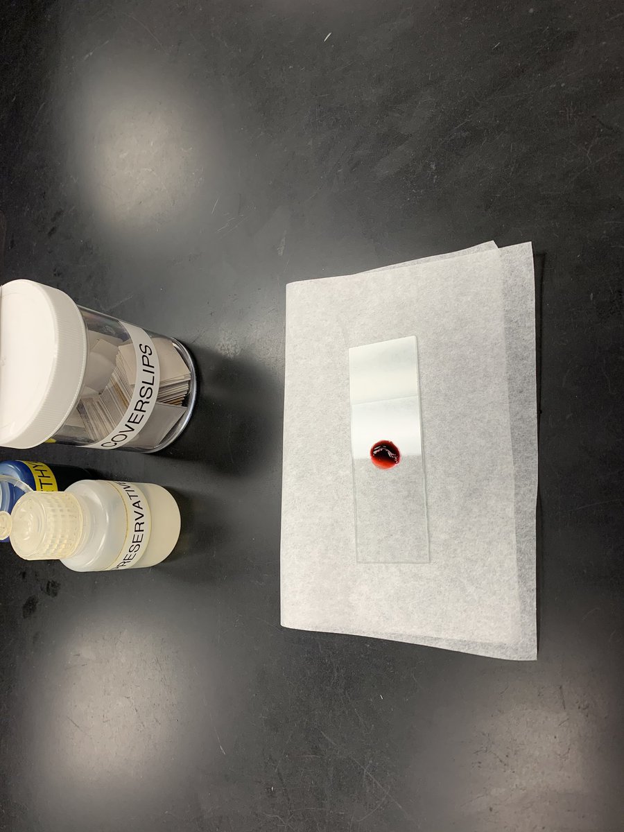 jardsd's tweet photo. Professor Burgess makes it impossible for you not to like science! My favorite part of today’s lab was learning and observing the different phases of mitosis in the garlic roof tip under a microscope. #splittingup #celldivision #mitosismakestwo #breakingupishard https://t.co/lDECOgEiNM
