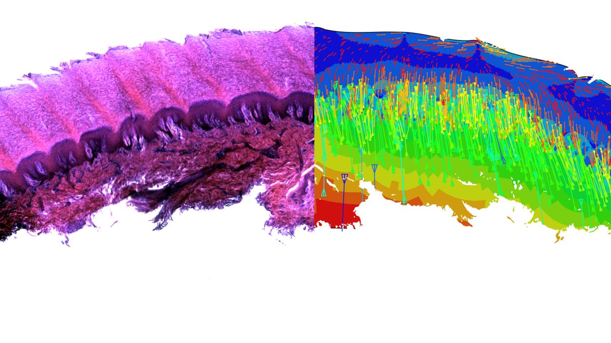 Our latest paper is out now at <a href="/ScienceAdvances/">Science Advances</a>! Led by @col_boyle, we reveal how skin on the soles of our feet can tolerate its extreme mechanical environment. advances.sciencemag.org/content/5/10/e…
<a href="/EPSRC/">Engineering and Physical Sciences Research Council</a> <a href="/AFR_UK/">AnimalFreeResearchUK</a> <a href="/imperialcollege/">Imperial College London</a> <a href="/ImperialBioeng/">Imperial Bioengineering</a> (1/6)
