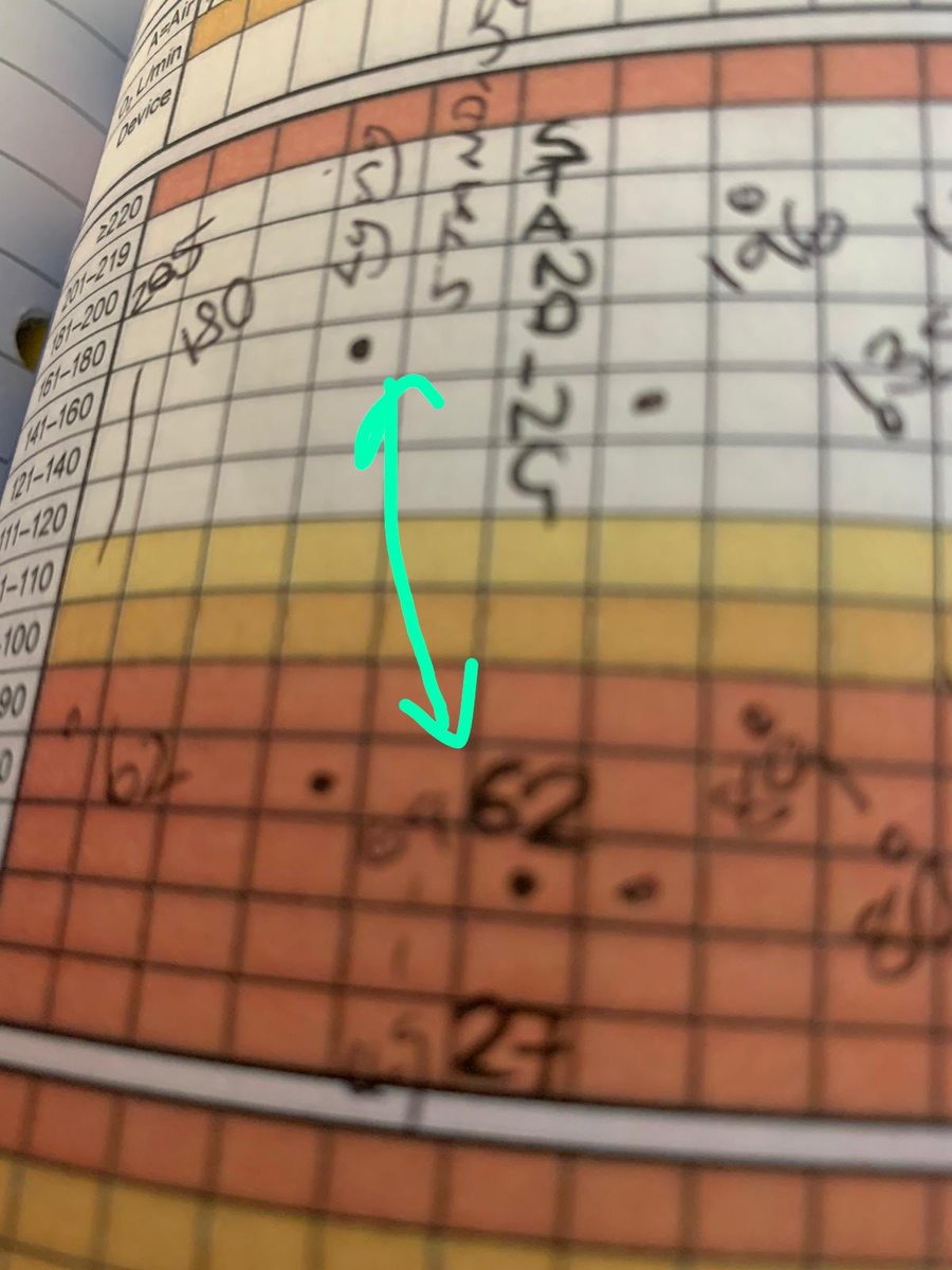 Amanda Fearon ๐ (@amandafearon87) on Twitter photo Just a slight postural drop there ๐ฎ Evidencing the importance of lying and standing blood pressure in #fallsprevention @tgicftnursing <a href="/NHSImprovement/">NHS Improvement</a> #fallscquin <a href="/OliviaBillings4/">Olivia Billings</a> Just a slight postural drop there ๐ฎ Evidencing the importance of lying and standing blood pressure in #fallsprevention @tgicftnursing <a href="/NHSImprovement/">NHS Improvement</a> #fallscquin <a href="/OliviaBillings4/">Olivia Billings</a>