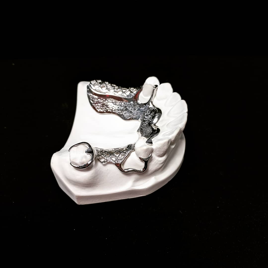 CaputoDental's tweet photo. Vitallium® 2000 chrome cobalt alloy partial denture metal framework. Alloy is nickel and beryllium-free. Cast clasps and a polished metal
https://t.co/ugFMIZv7wd
#dentallab #dentistry #dental #dentist #vitallium #teeth #framework #dentaltech #castmetal #dentures #partialdenture https://t.co/ezCLblUHRC