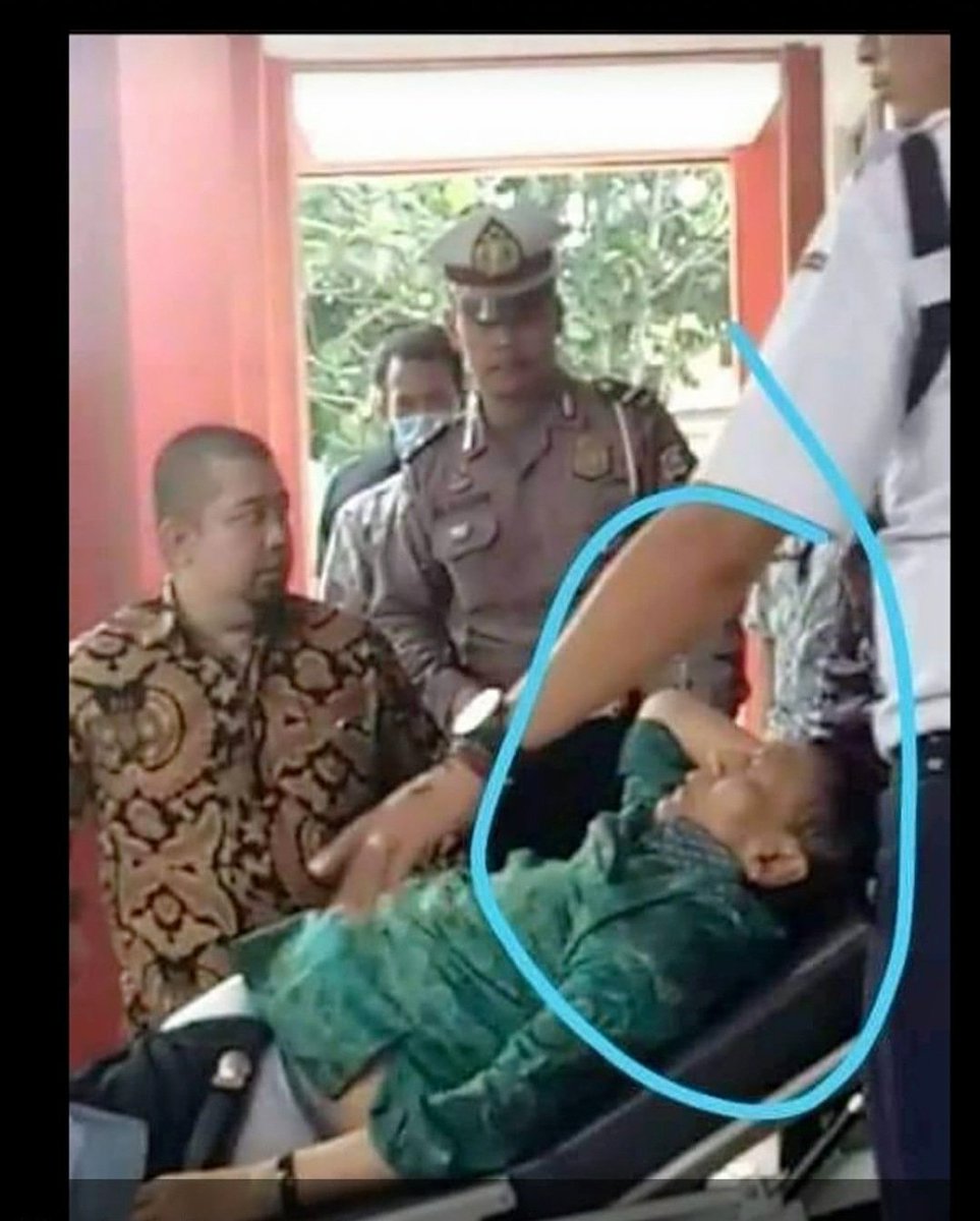 Koreksi kalau salah. 
1. Luka : luka bekas tusukan pasti sobek atau bolong dan pasti bercucuran darah ( kalau besar luka nya. 
2. Pakaian : bekas sayatan pasti ada yang sobek atau bolong 

Itu yang kelihatan. 

Tolong koreksi kalau ada yang salah. #WirantoDitusuk
