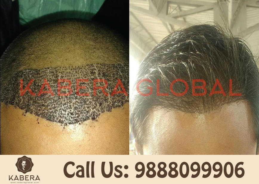 Kabera Global (@kaberaglobal) / Twitter Kabera Global (@kaberaglobal) / Twitter