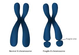 Today is European Fragile X Syndrome awareness day.  #FragileX is a chromosomal abnormality and is the most common form of inherited learning disability. It's called Fragile X as the end of the chromosome looks like it's about to drop off.
