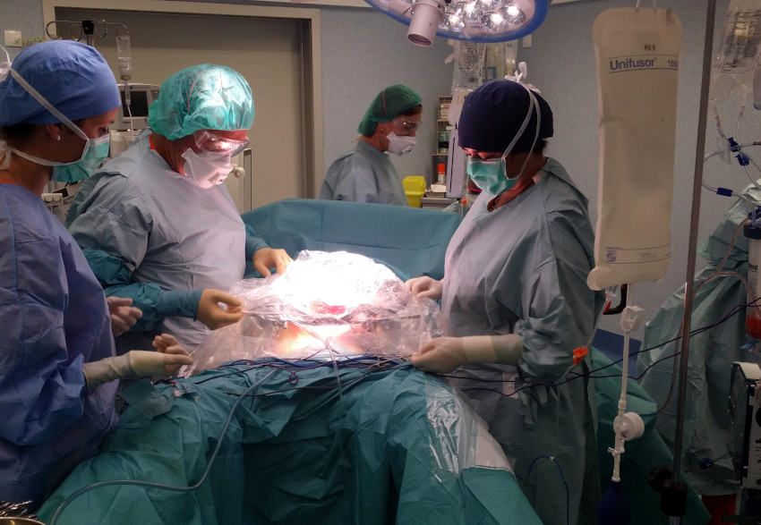 #PublicaSalutiB Detección y supresión automática de las grapas en imágenes de heridas de cirugía abdominal para aplicaciones m-Health buff.ly/3236xyR <a href="/cgdsonespases/">CGD Son Espases</a> <a href="/sobacir/">SOBACIR</a> buff.ly/33k0Wo8 <a href="/SonEspases/">HU Son Espases</a>