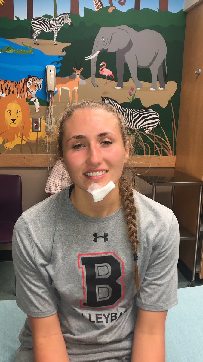 yeah she has to get stitches #shecamebackthough <a href="/mckennadietz/">McKenna Dietz</a>