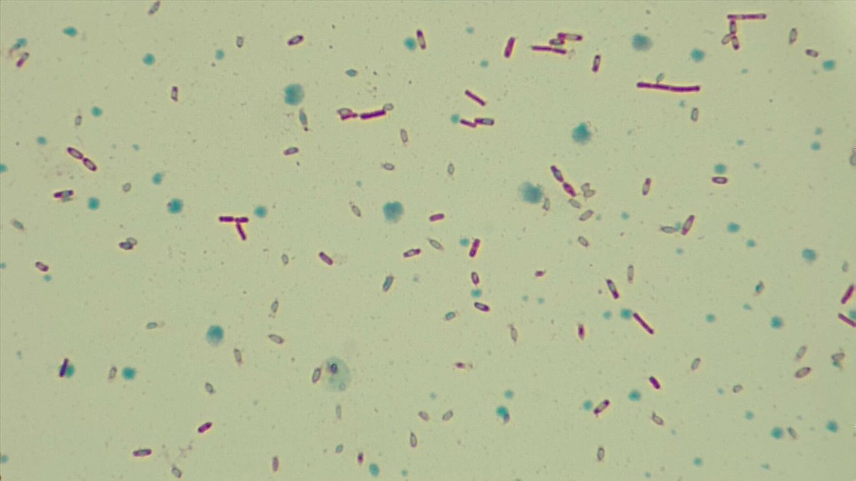Preparación de esporas de Clostridium difficile.. #hoyenpracticas 😍