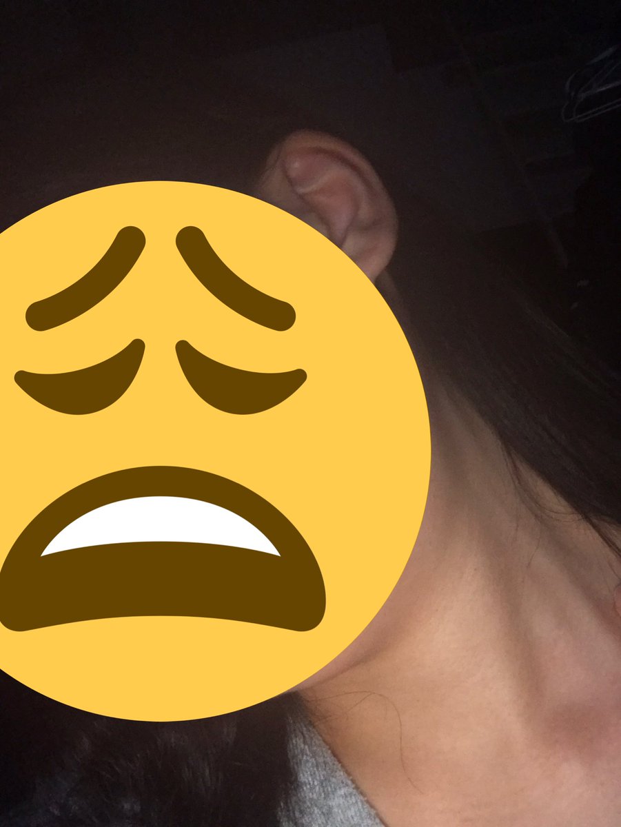 黎 過食嘔吐 拒食の悪化中 今日ふと鏡みたら 唾液腺がパンパンで エラ張り顔で元から顔がでかいのにその倍にもなってるんじゃないかってくらいで首も太いし 筋トレも出来なくなってしまったから脚も太いしおしりもデカいしでとても辛い とてもブス