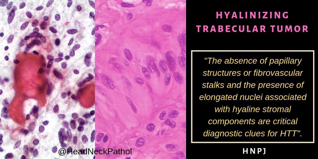 Gerônimo Jr. tweet media