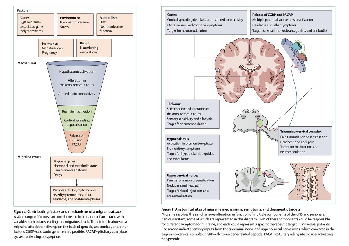 Migraine Pathophysiology Migraine Treatment Advances! The