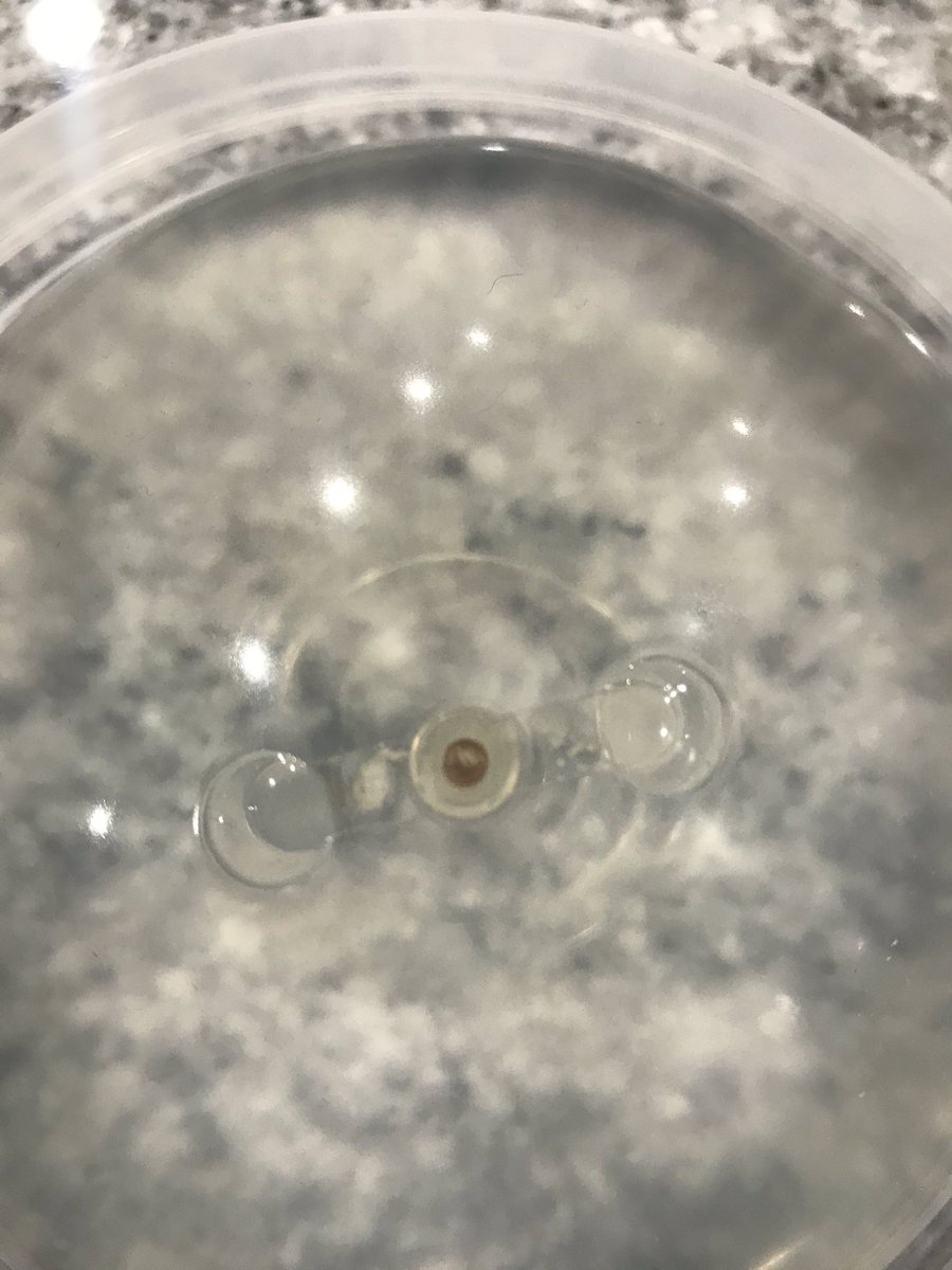 ashleybmac's tweet image. Mold around the value of my breast implants. High heavy metals and toxins in the body. 5 autoimmune labels and brain inflammation. This is breast implant illness. This is manmade autoimmune. There is no safe implant @FDACommissioner time for change. Ban them!