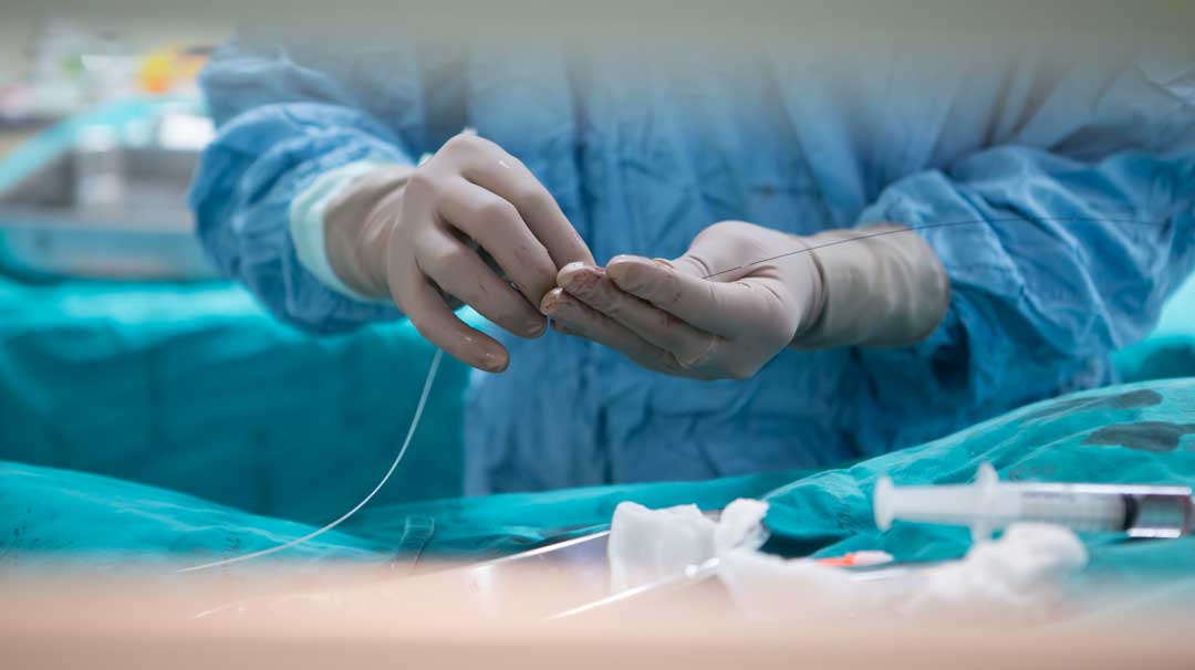 SERVEISoc's tweet photo. ¿Has oído en la consulta palabras como #arteriografía o #angiografía 🤔 y no sabes lo que son? 

✅ Te dejamos una completa explicación de cómo se realizan y para qué sirven estos procedimientos! 

https://t.co/m0x4iJTtM4…

#radiologiaintervencionista #pacientes #FFpaciente https://t.co/JZOc15N4pD