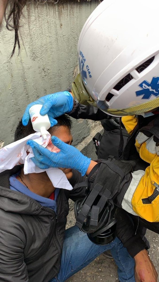 CONAIE_Ecuador's tweet photo. #ATENCION 

Con esto el Gobierno responde al pueblo ecuatoriano que se moviliza por sus derechos, violencia desmedida @mariapaularomo 

@ONUecuador @ONU_es @CIDH 

#RomoCriminal 
#JarrinCriminal https://t.co/08uMmQ08Gj