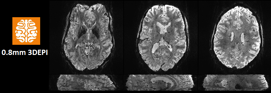 Exciting opportunity to come and join the @WCHN_UCL  Maguire Memory Lab using our fab new 7T MRI scanner to study memory!

More info here: tinyurl.com/y3ukmbgv

First high resolution 3D-EPI on the #7T #Terra looking good! 🤟