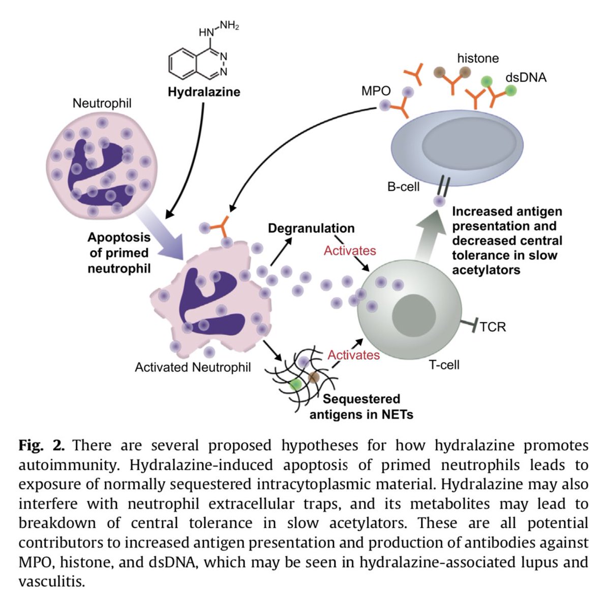 Edgar V. Lerma 🇵🇭 on Twitter "Hydralazineassociated vasculitis