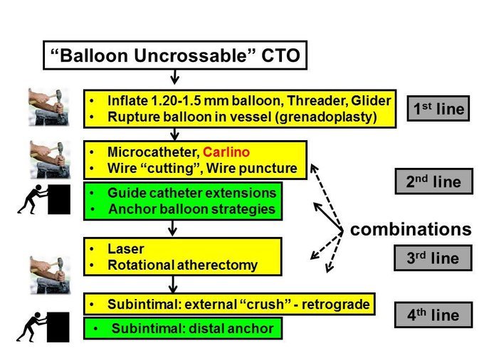 BrianBergmark's tweet image. Helpful balloon uncrossable lesion algorithm from @esbrilakis. Warming up the laser when the final 1.0 mm grenadoplasty did the trick. #PCIMasters @jason_wollmuth @ekgpdx @duanepinto @kevinjamescroce @NBrokob @CoreyRogers777 @tomfenton67
