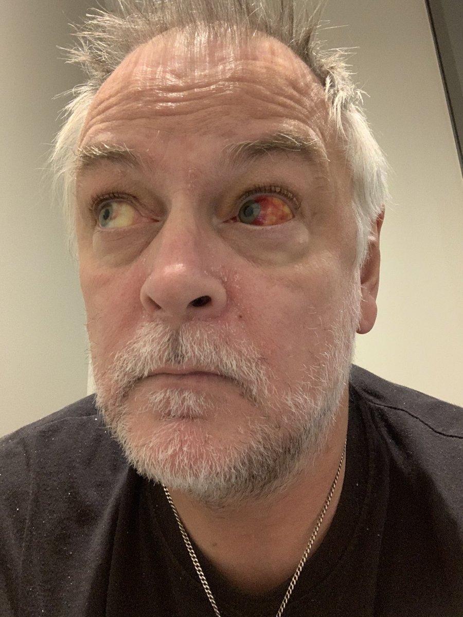 Papanomaly tweet media