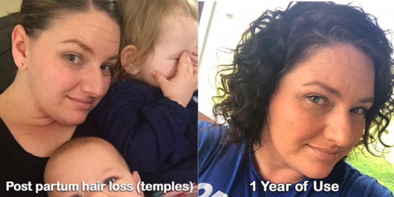 Celmd_beauty's tweet photo. Postpartum #hairloss affects up to 50% of moms, so why isn't it spoken about?! Read about @TheMamaMinder's story of hair loss and regrowth here! https://t.co/5eWgu58b1R
Share yours too!
#celmdreview #celmd #celhairresults #FridayMotivation #FridayThoughts #moms #beautyblogger https://t.co/f9ZB2gyxPU