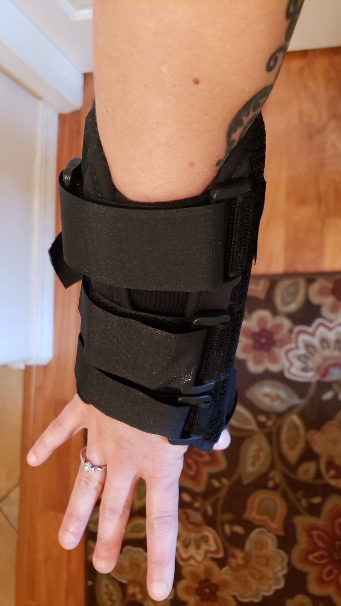 cmenowbsu's tweet photo. So this happened and now my gaming days are on a standstill until they can fix the compressed nerve in my hand... https://t.co/nK8qRwI6ga