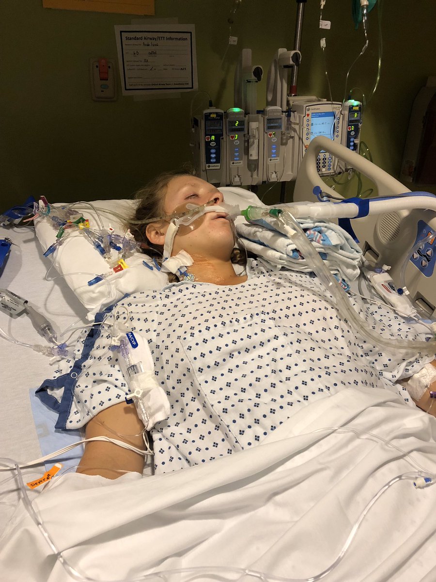 Allie_Pritchett's tweet photo. ONE YEAR AGO: My sister had a 13+ hour surgery to remove 3 1/2 organs, and I’m so thankful that I can say she’s no longer in pain! There are still hard days, but I’m so proud of how much she has overcome. #beatpancreatitis 💜 https://t.co/4yhCYrOSHn